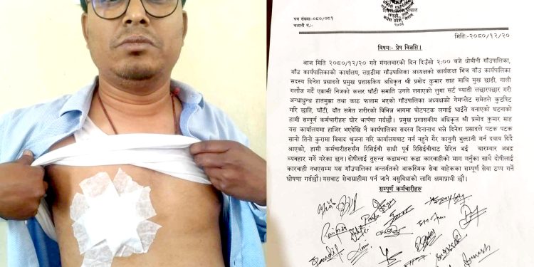 धोबिनीका प्रमुख प्रशासकीय अधिकृत साहमाथि जनप्रतिनिधिबाट कुटपिट, छातीमा गम्भिर चोट